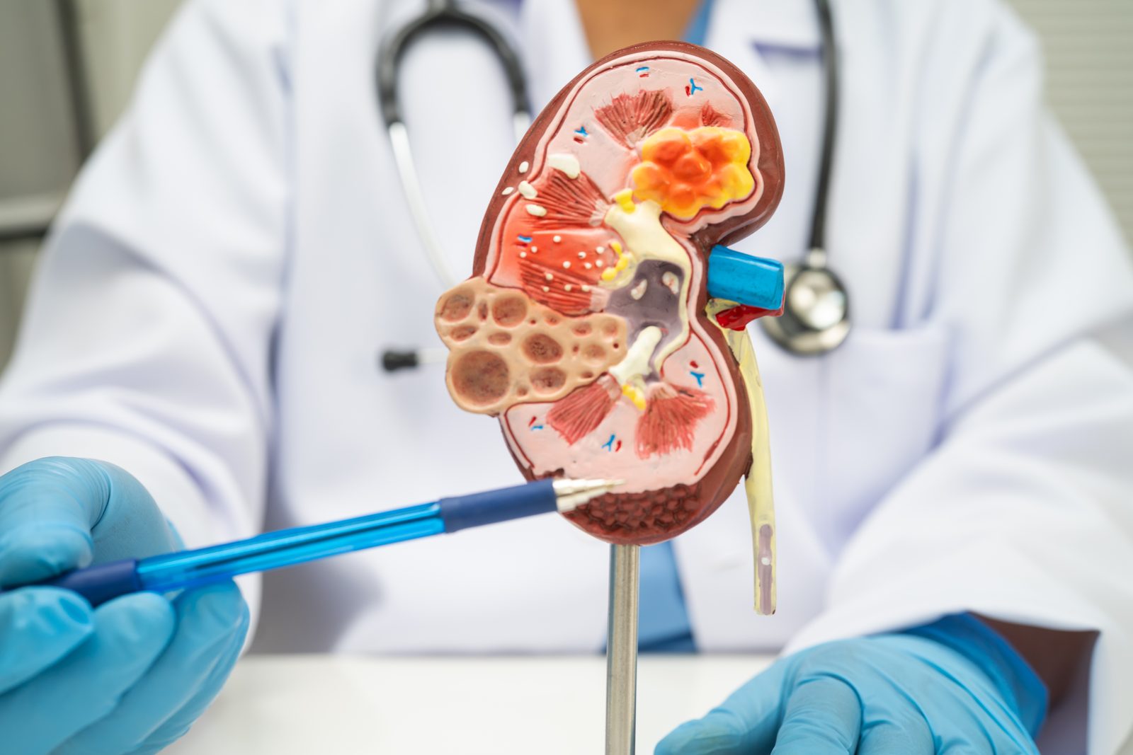 Nephrology care at SLMA