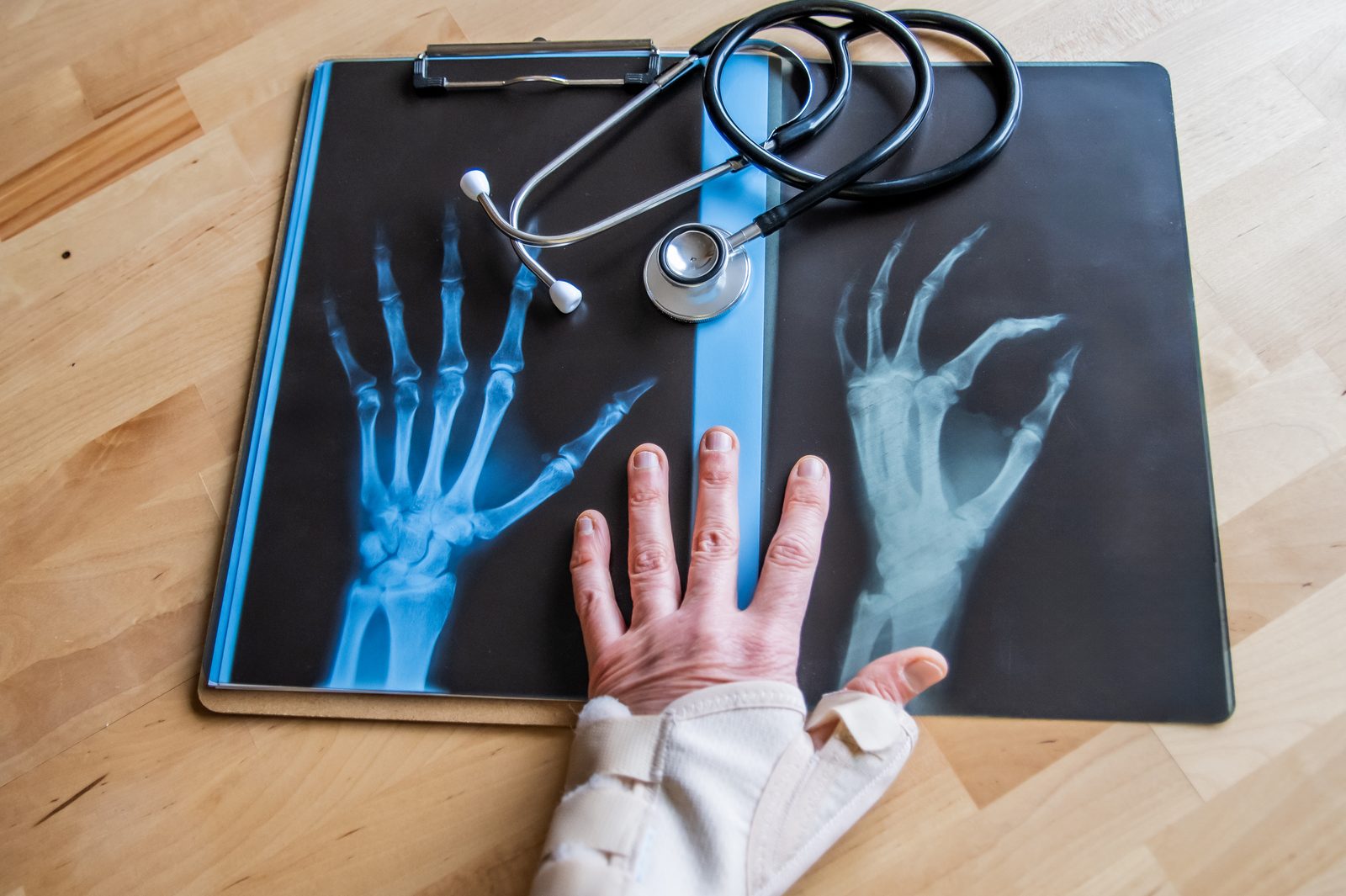 Rheumatology care at SLMA