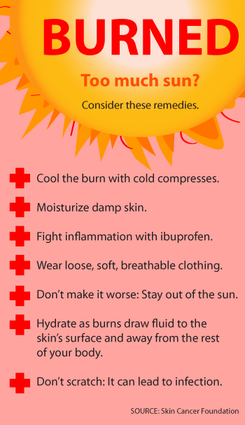 sunburn remedies