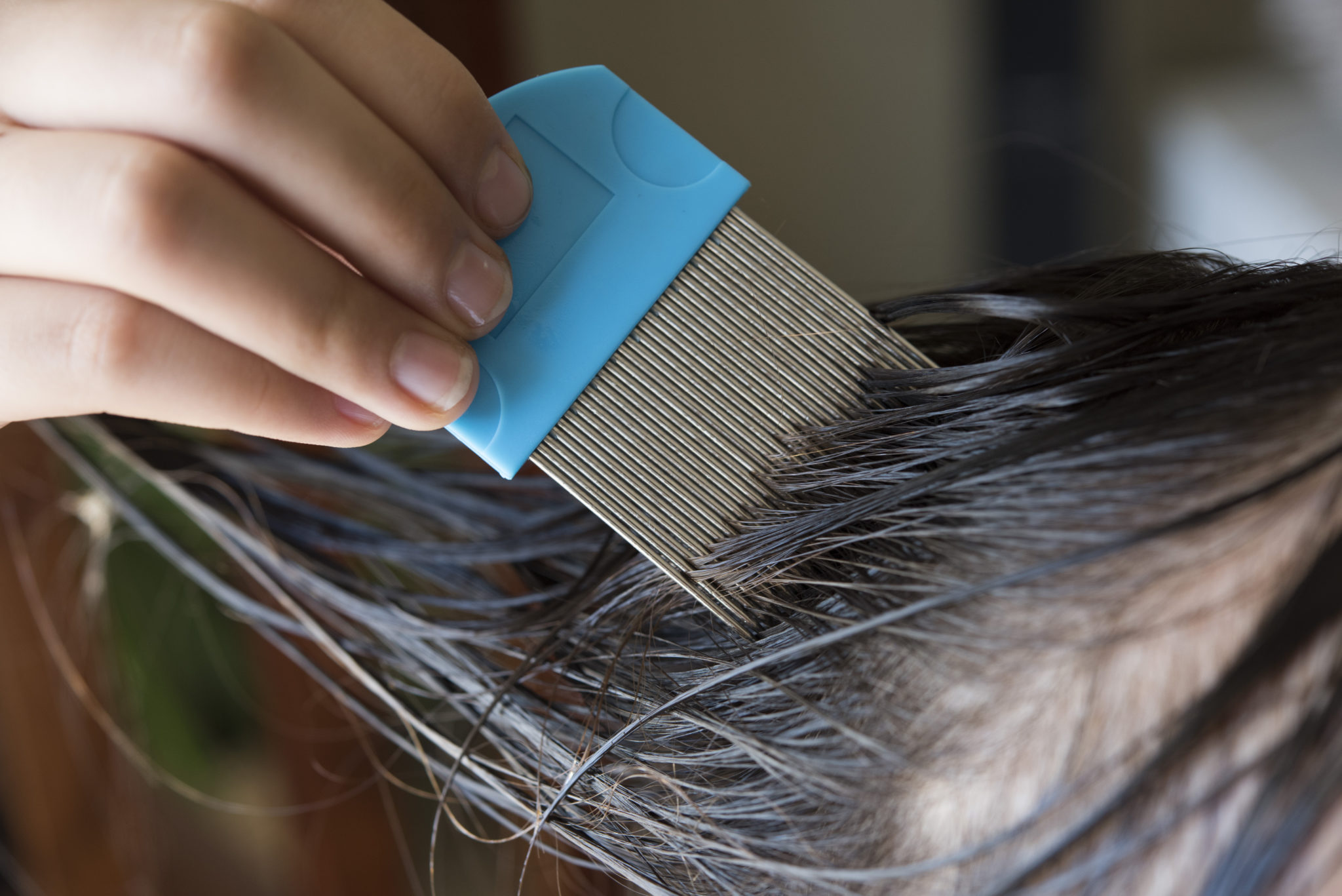 The Way of Lice - Everything You need to Know about Head Lice - SLMA
