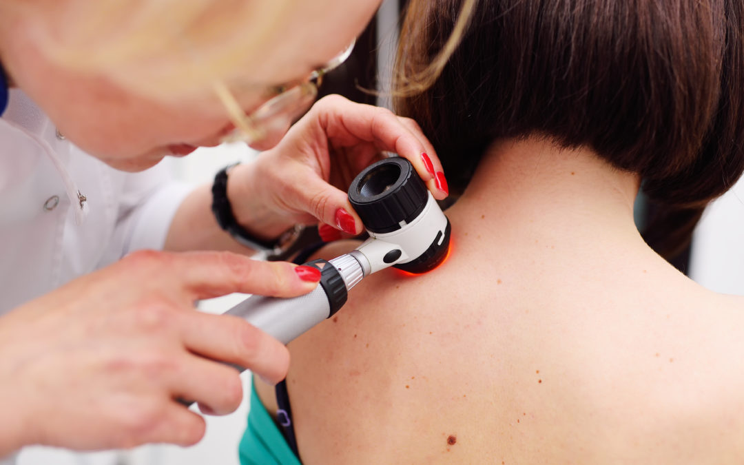 Melanoma Vs. Carcinoma: What’s the Difference?