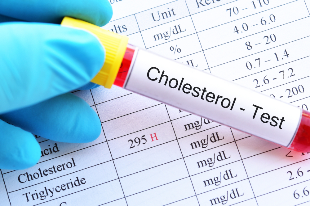 Cholesterol blood test